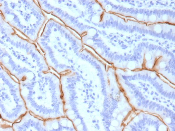 Mucin 13 Antibody in Immunohistochemistry (IHC (P))