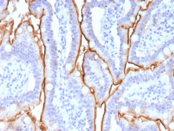 Mucin 13 Antibody in Immunohistochemistry (IHC (P))