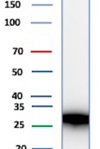 CALB1 Antibody in Western Blot (WB)