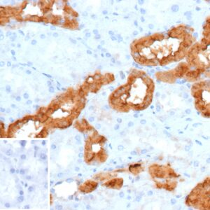 Calbindin Antibody in Immunohistochemistry (IHC (P))