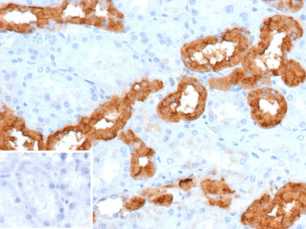 Calbindin Antibody in Immunohistochemistry (IHC (P))