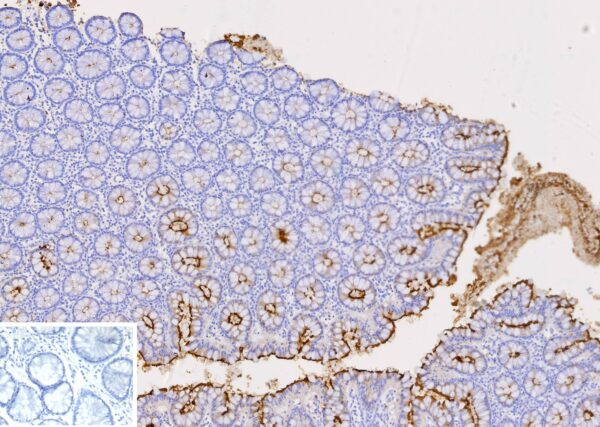 CEACAM1 / CD66a Antibody in Immunohistochemistry (IHC (P))