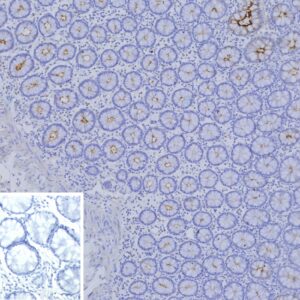 CEACAM1 / CD66a Antibody in Immunohistochemistry (IHC (P))