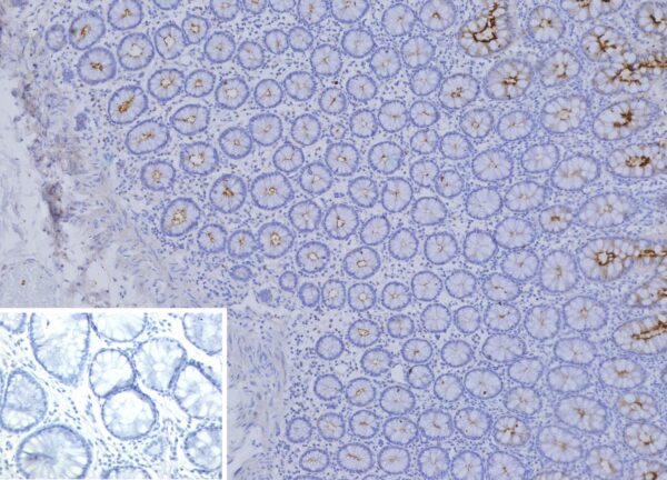 CEACAM1 / CD66a Antibody in Immunohistochemistry (IHC (P))