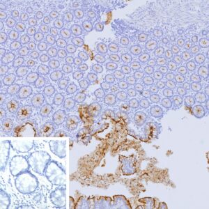 CEACAM5 Antibody in Immunohistochemistry (IHC (P))