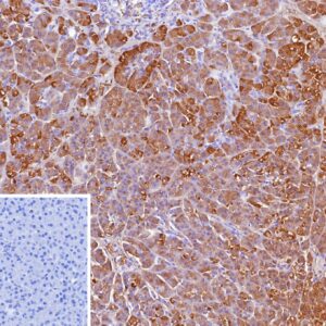 CELA3A Antibody in Immunohistochemistry (IHC (P))