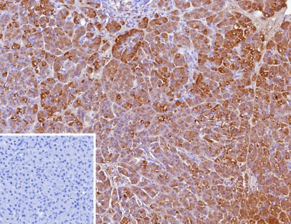 CELA3A Antibody in Immunohistochemistry (IHC (P))