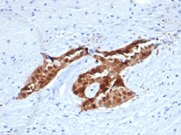 Calretinin Antibody in Immunohistochemistry (IHC (P))