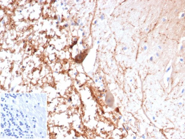 Calretinin Antibody in Immunohistochemistry (IHC (P))