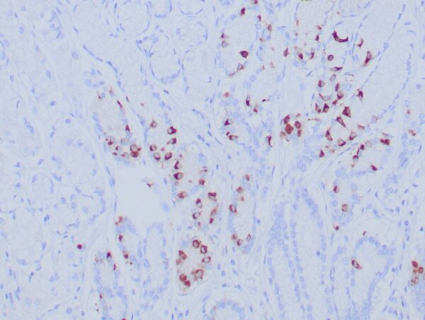 Gastrin Antibody in Immunohistochemistry (IHC (P))