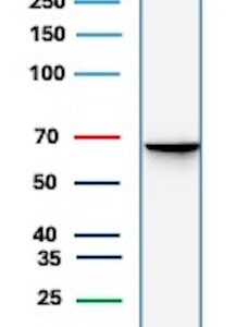 Estrogen Receptor alpha Antibody in Western Blot (WB)