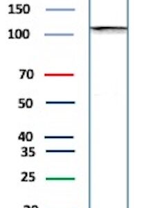 SATB2 Antibody in Western Blot (WB)