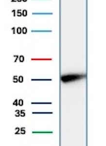 Cytokeratin 14 Antibody in Western Blot (WB)