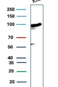 CD10 Antibody in Western Blot (WB)