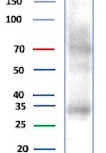 Parvalbumin Antibody in Western Blot (WB)