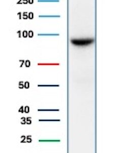 STAT6 Antibody in Western Blot (WB)