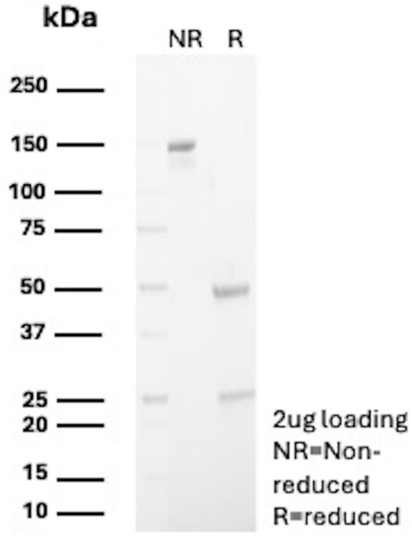 Calbindin Antibody in SDS-PAGE