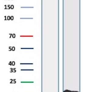 CD3D Antibody in Western Blot (WB)