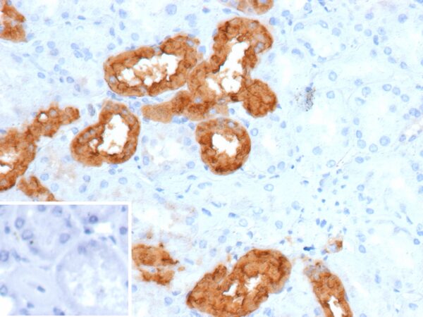 Calbindin Antibody in Immunohistochemistry (IHC (P))