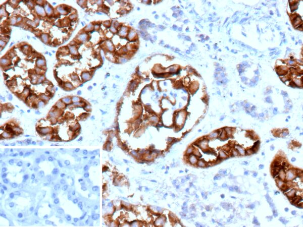 CD10 Antibody in Immunohistochemistry (IHC (P))