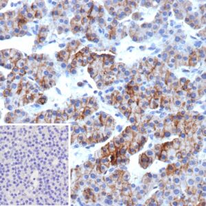 ALCAM / CD166 Antibody in Immunohistochemistry (IHC (P))