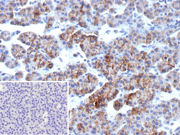 ALCAM / CD166 Antibody in Immunohistochemistry (IHC (P))