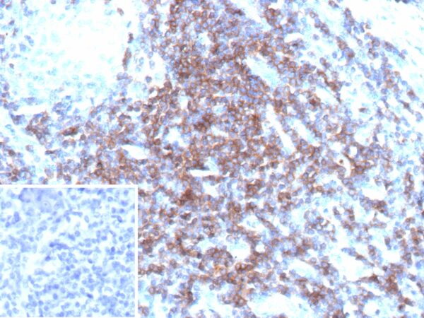 T-Cell Receptor delta Antibody in Immunohistochemistry (IHC (P))