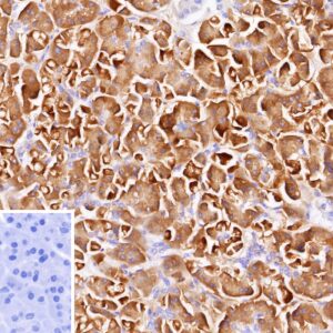 Colipase Antibody in Immunohistochemistry (IHC (P))