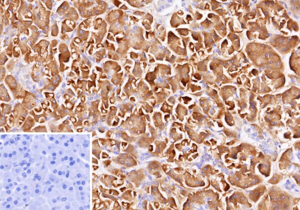 Colipase Antibody in Immunohistochemistry (IHC (P))