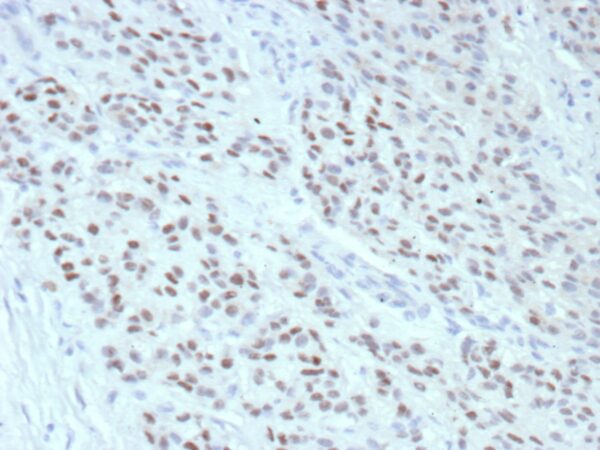 ESR1 Antibody in Immunohistochemistry (IHC (P))