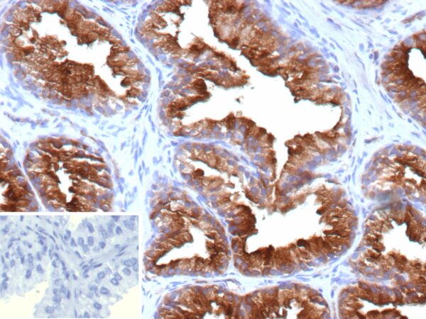 PSMA Antibody in Immunohistochemistry (IHC (P))