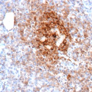 Glucagon Antibody in Immunohistochemistry (IHC (P))