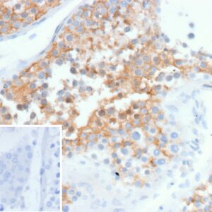 Osteonectin Antibody in Immunohistochemistry (IHC (P))