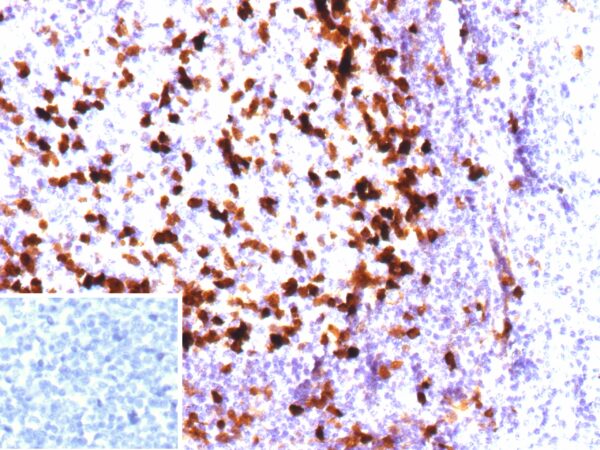 Parvalbumin Antibody in Immunohistochemistry (IHC (P))