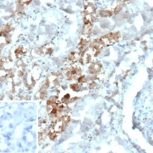 Parvalbumin Antibody in Immunohistochemistry (IHC (P))