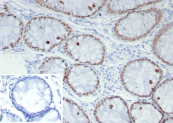 SATB2 Antibody in Immunohistochemistry (IHC (P))