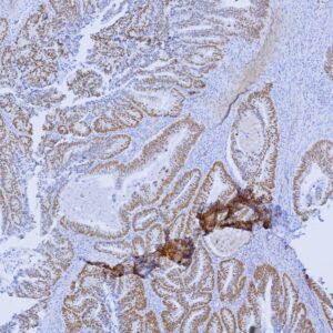 SATB2 Antibody in Immunohistochemistry (IHC (P))