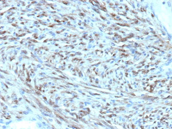 STAT6 Antibody in Immunohistochemistry (IHC (P))