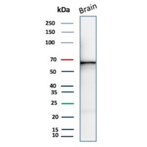 GAD67 Antibody in Western Blot (WB)