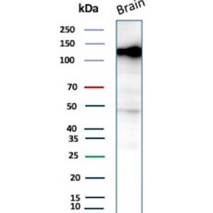 BCOR Antibody in Western Blot (WB)