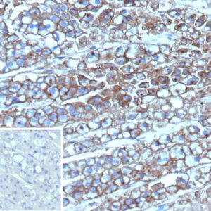 p170 / MDR1 Antibody in Immunohistochemistry (IHC (P))