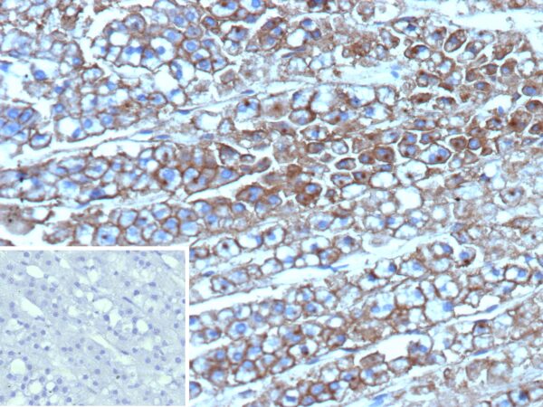 p170 / MDR1 Antibody in Immunohistochemistry (IHC (P))