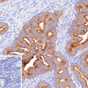 MUC16 Antibody in Immunohistochemistry (IHC (P))