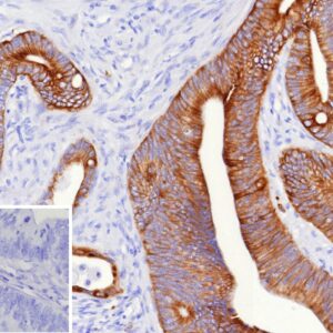 MUC16 Antibody in Immunohistochemistry (IHC (P))