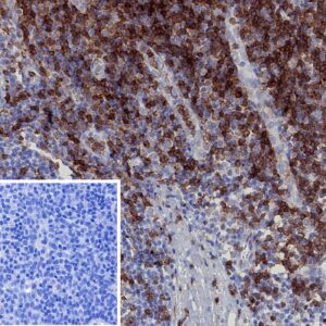 CD2 Antibody in Immunohistochemistry (IHC (P))