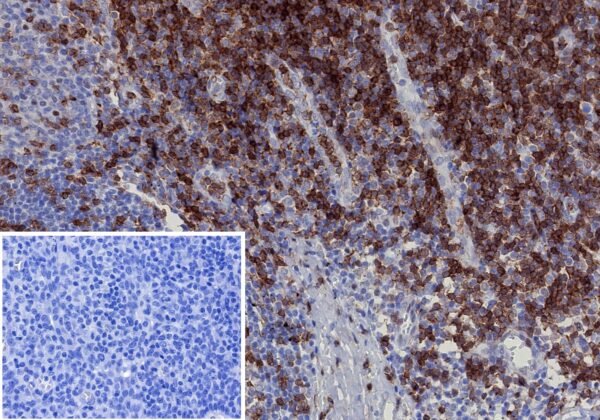 CD2 Antibody in Immunohistochemistry (IHC (P))