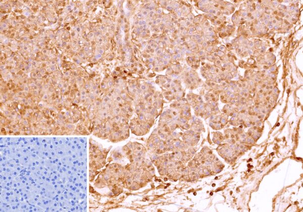 CD99 Antibody in Immunohistochemistry (IHC (P))