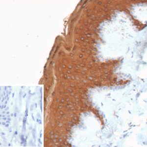 Formalin-fixed, paraffin-embedded human skin stained with Cytokeratin 10 Recombinant Rabbit Monoclonal Antibody (KRT10/9605R). Inset: PBS instead of primary antibody; secondary only negative control. 