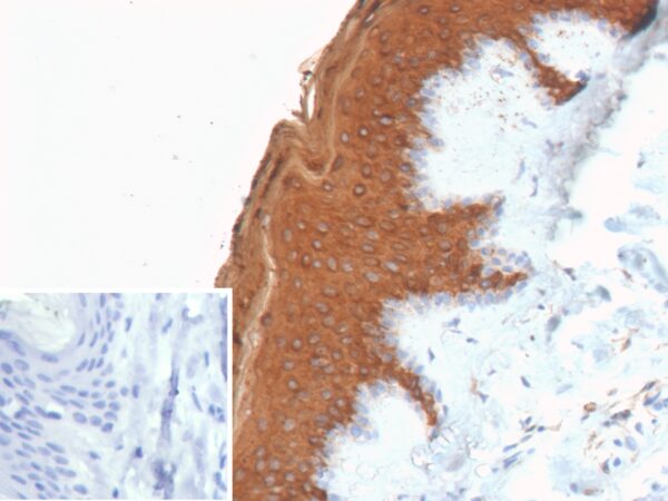 Recombinant Cytokeratin 10 (KRT10) (Suprabasal Epithelial Marker) Antibody