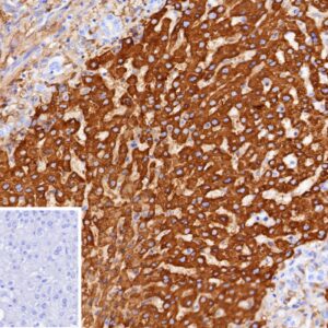 CPS1 Antibody in Immunohistochemistry (IHC (P))